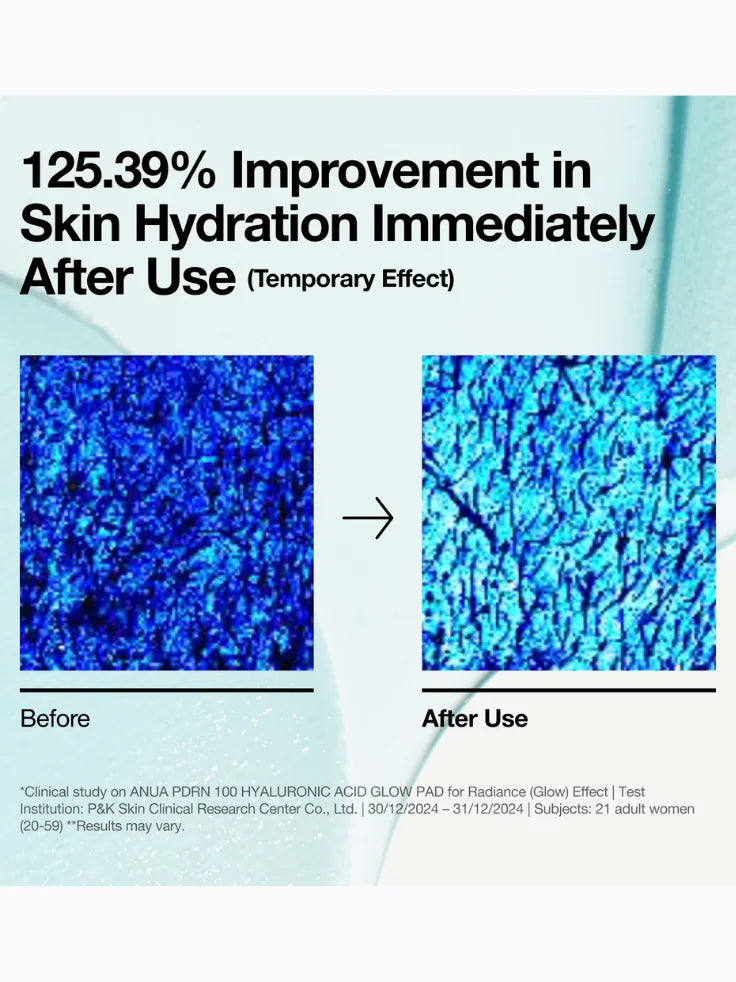 Customer testimonial video showing dramatic improvement in wrinkles and firmness, promoting the best ANUA anti-aging Glow Pads.
