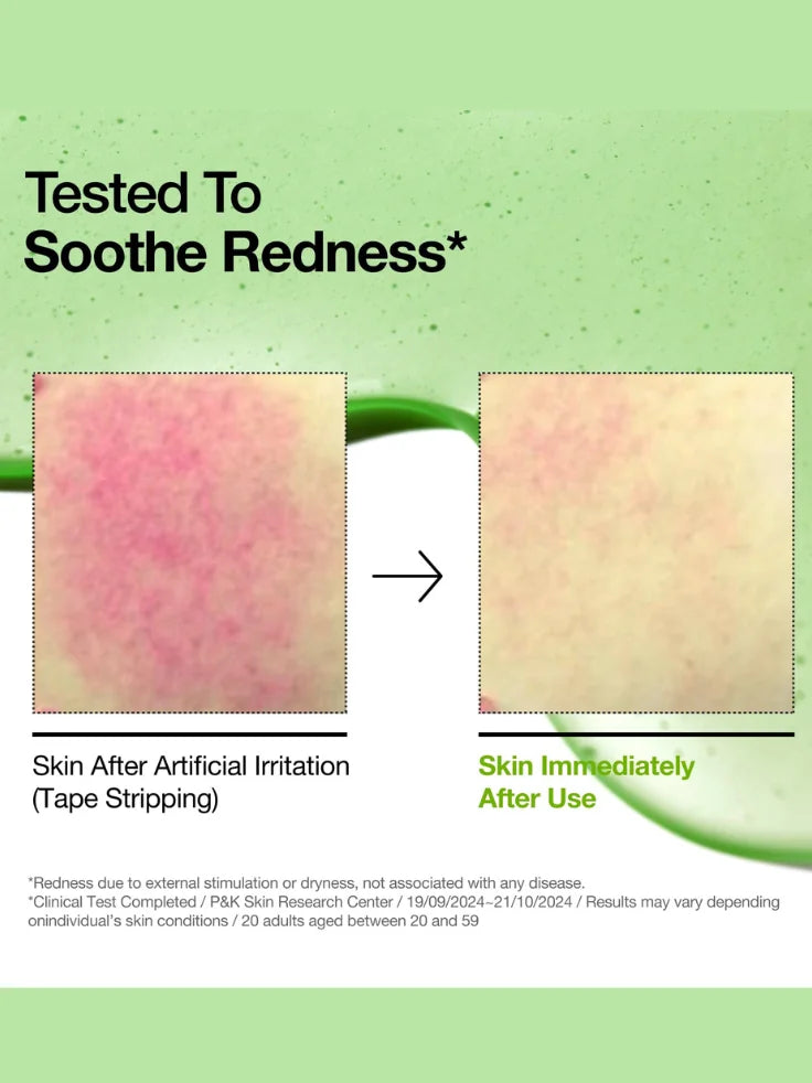 Before and after using Anua Azelaic Acid serum, showing reduced skin redness and improved complexion.