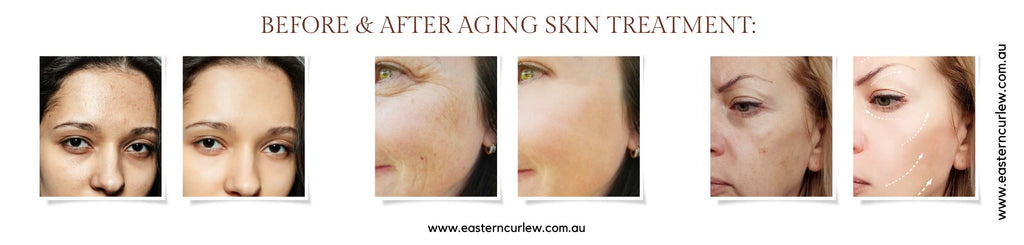 Before After Aging Skin treatment | Eastern Curlew