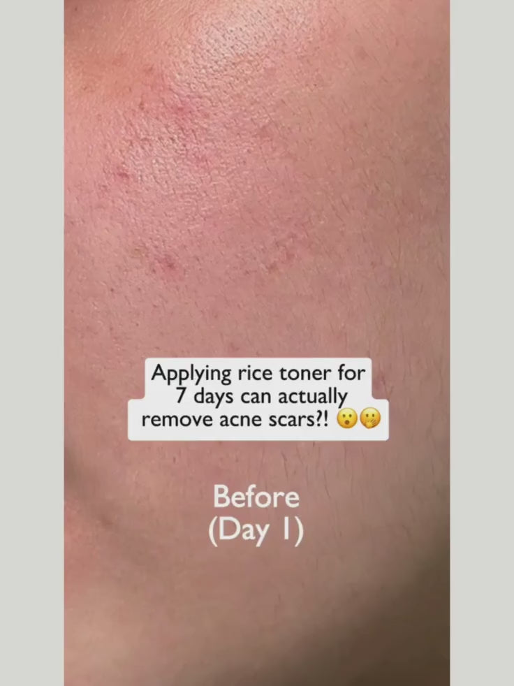 Close-up of Anua Rice 70 Glow Milky Toner texture showing milky formula