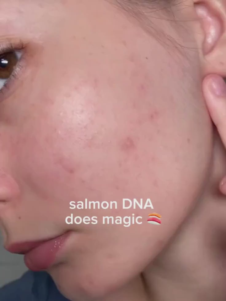 Video demonstration: How to use the ANUA PDRN 100 Glow Pad dual sides for exfoliation and a deep anti-aging essence mask treatment.